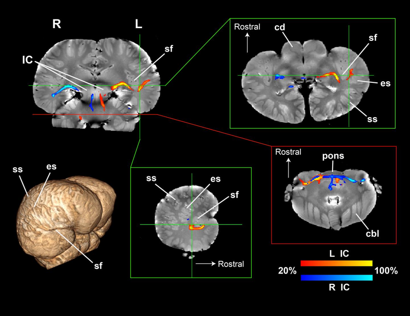 Illustration for article titled New Brain Scans Show How Dolphins Use Sound to See